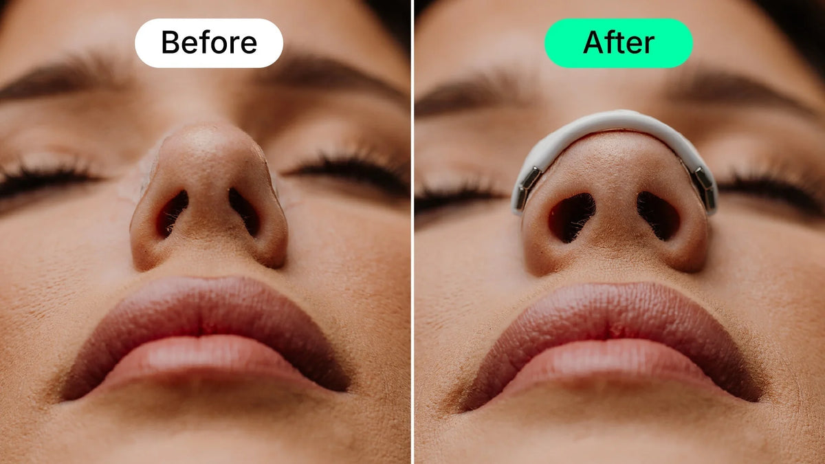`BreathLab™ Magnetic Nasal Strips